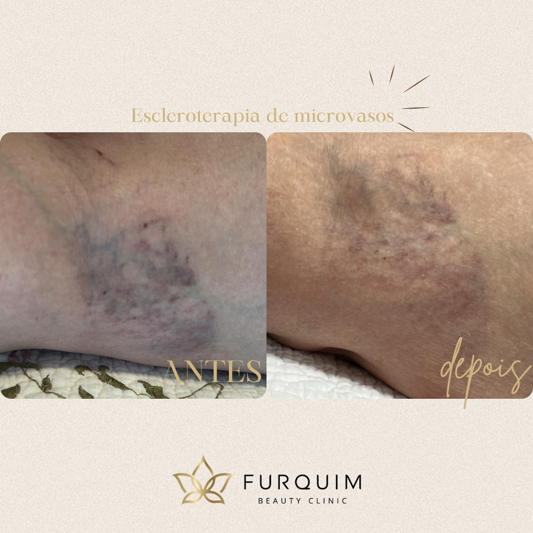 Tratamento Facial